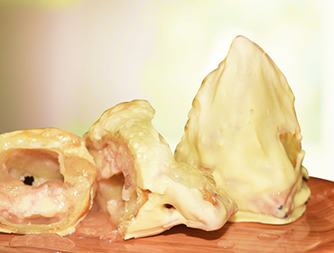 Pineapple Samosa